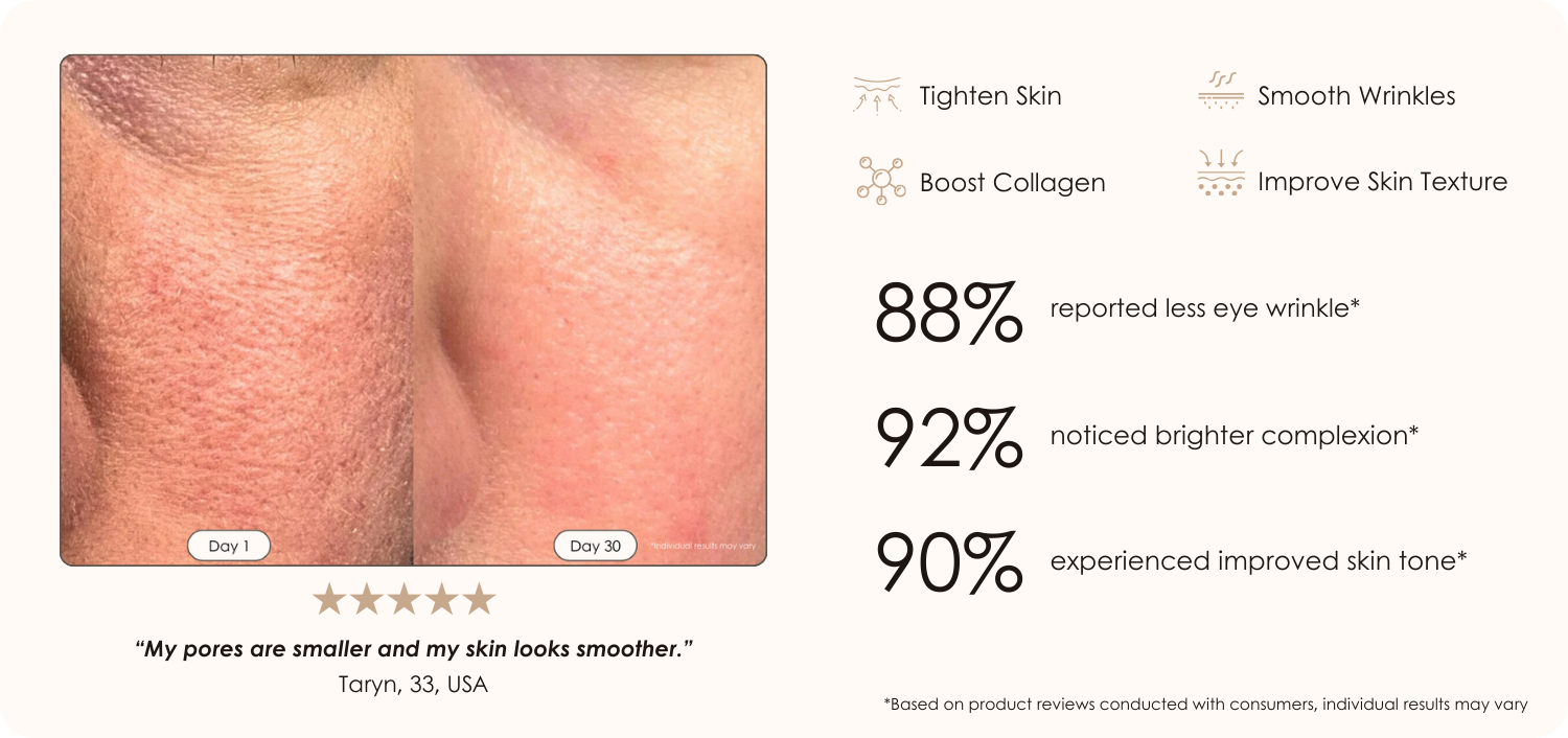 Faisca Neon High Frequency Wand before and after results showing smaller pores and brighter complexion