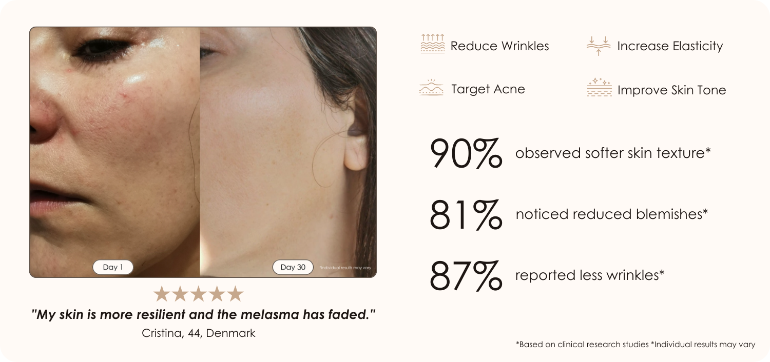 Lumamask 7 LED light therapy face mask before and after results showing improved melasma and hyperpigmentation